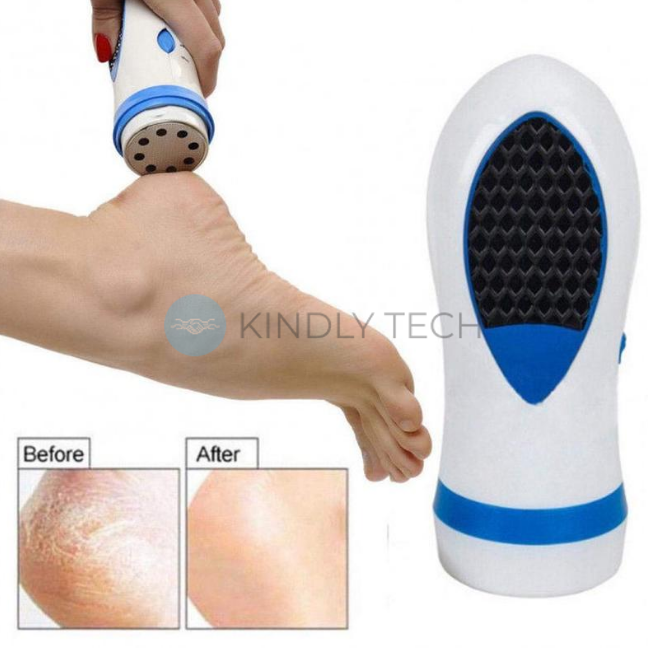 Електрична пемза Pedi Spin Набір для педикюру