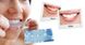 Отбеливающие полоски для зубов Ultra Gel Whitening